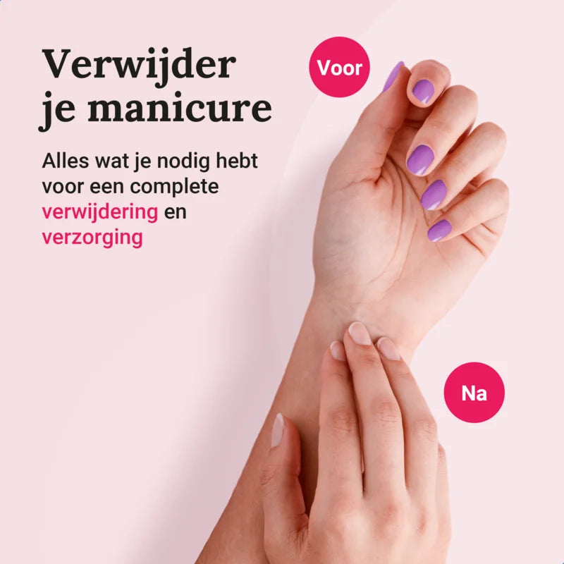 Miss Jules - Nagellak Remover Set - Voor en Na