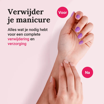Miss Jules - Nagellak Remover Set - Voor en Na